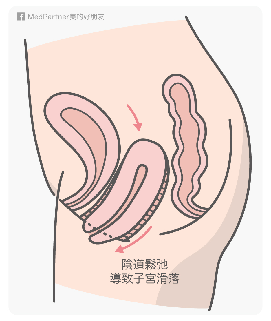 私密處特輯 陰部的生理介紹與陰道雷射完整全攻略 美的好朋友