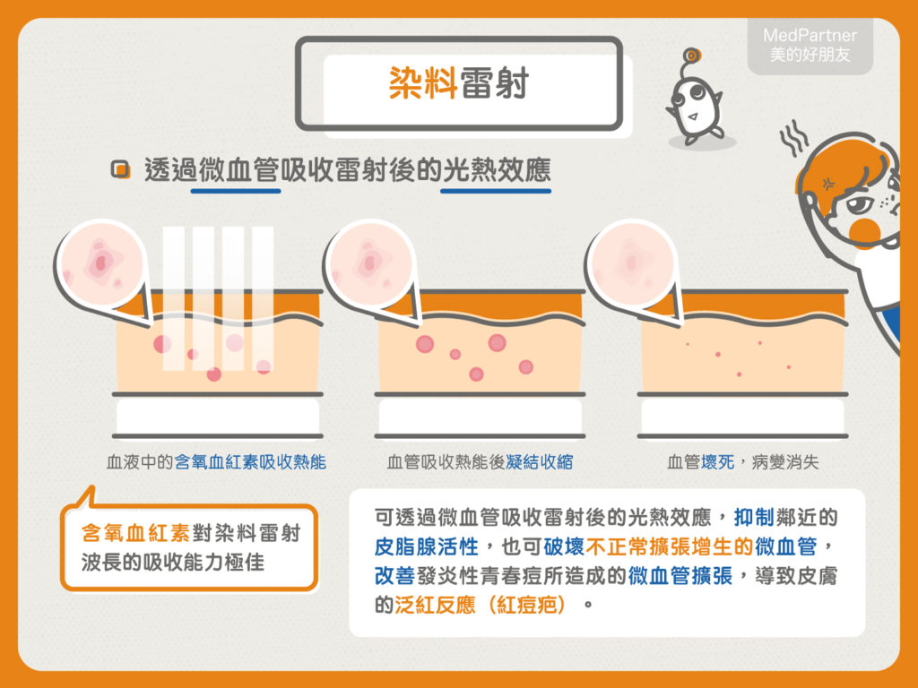 懶人包＿光電治療1-5 (1)