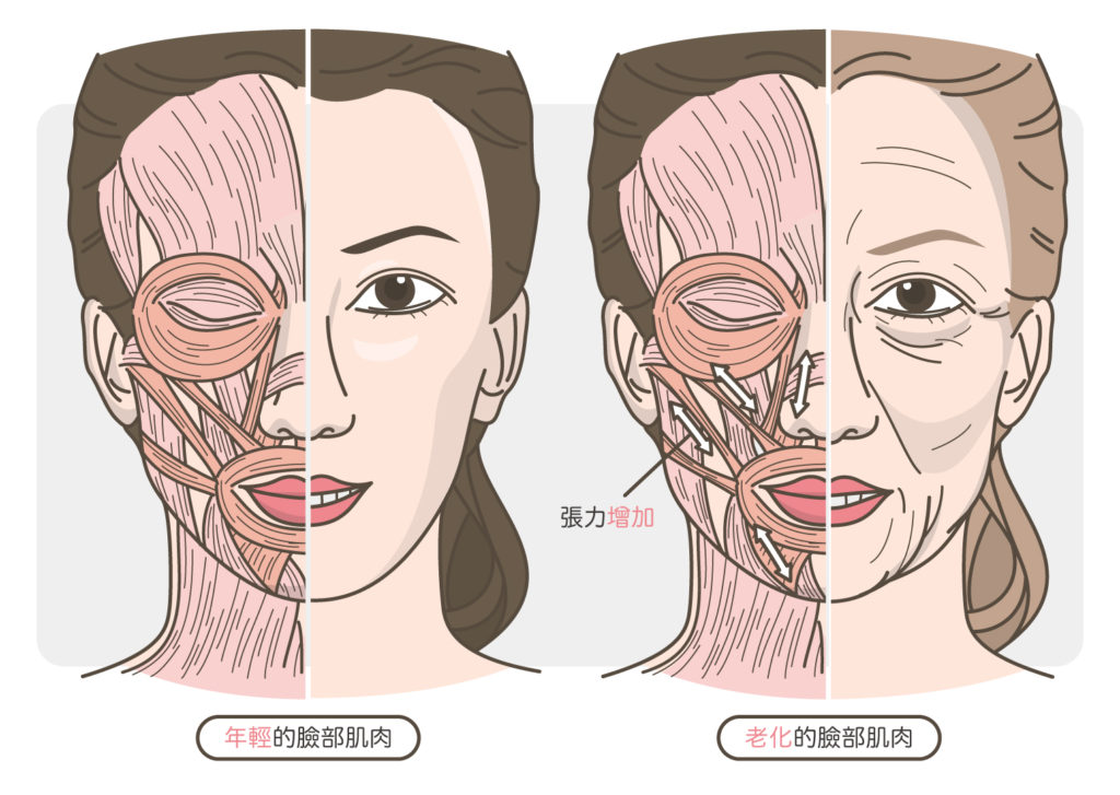 臉部肌肉的老化