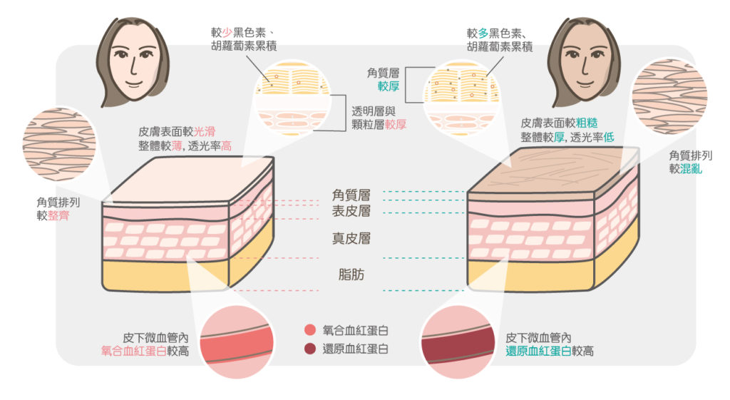 皮膚比較