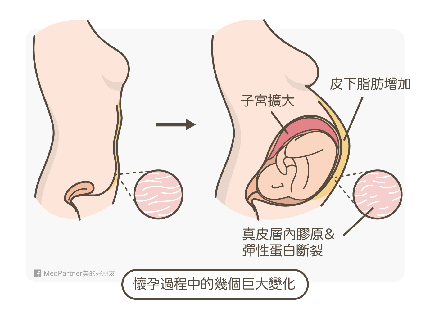 æ·å­éç¨çè®å