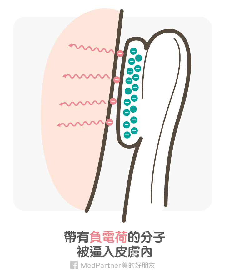 離子導入儀