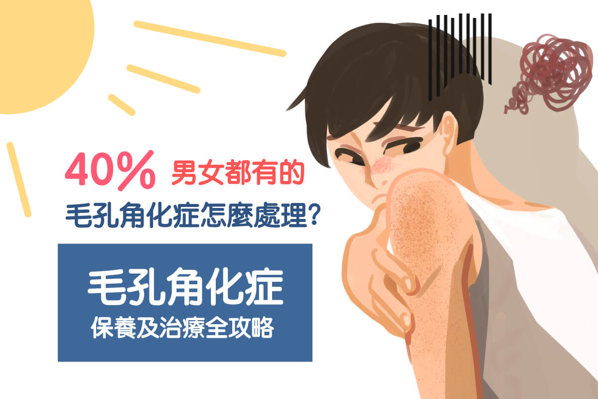 40%男女都有的毛孔角化症怎麼處理？毛孔角化症保養及治療全攻略 美的 