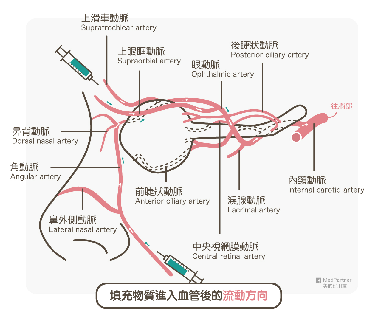 注射物質流動