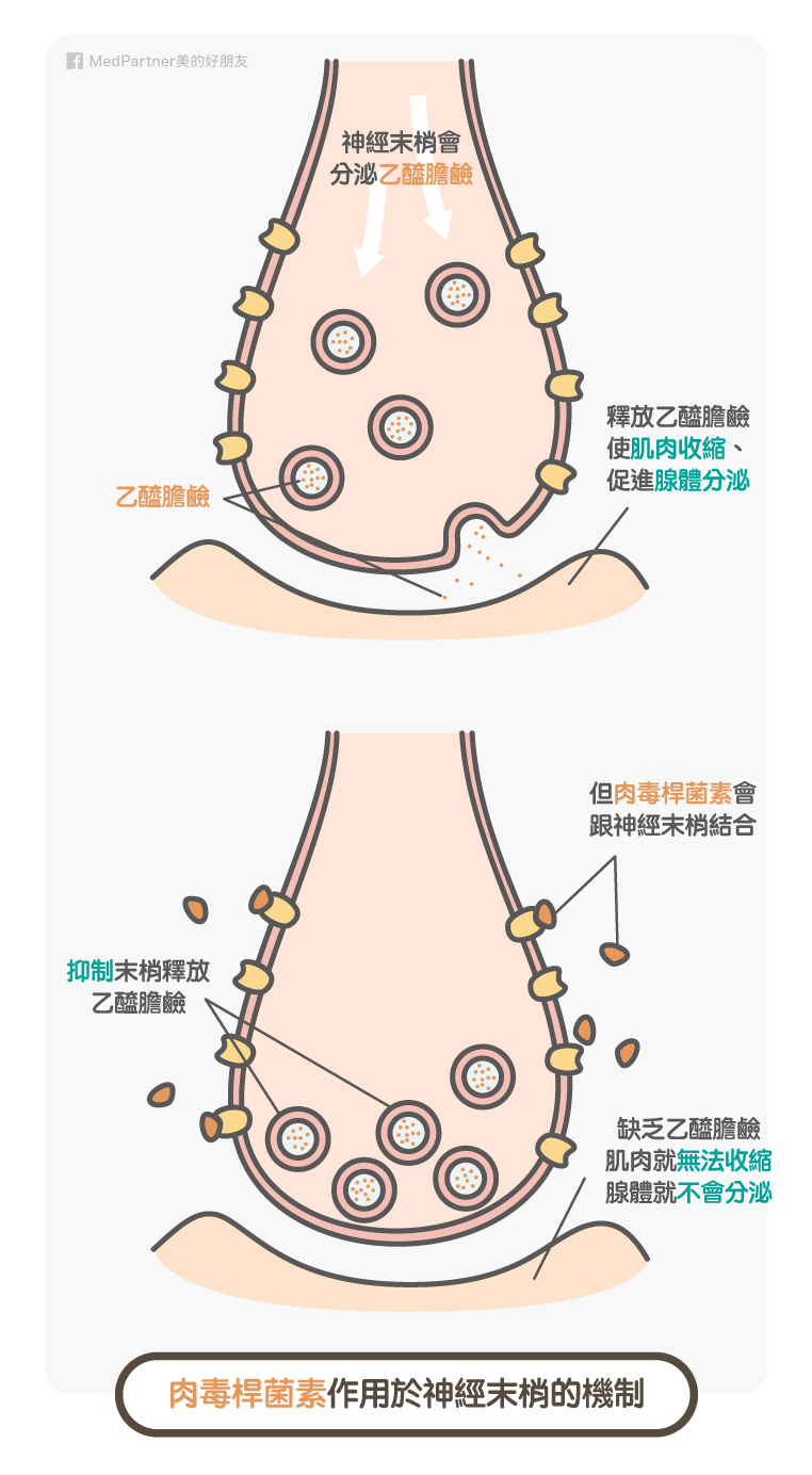 肉毒桿菌素作用機制