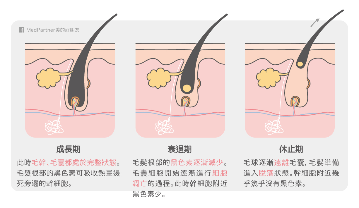 毛囊生長周期