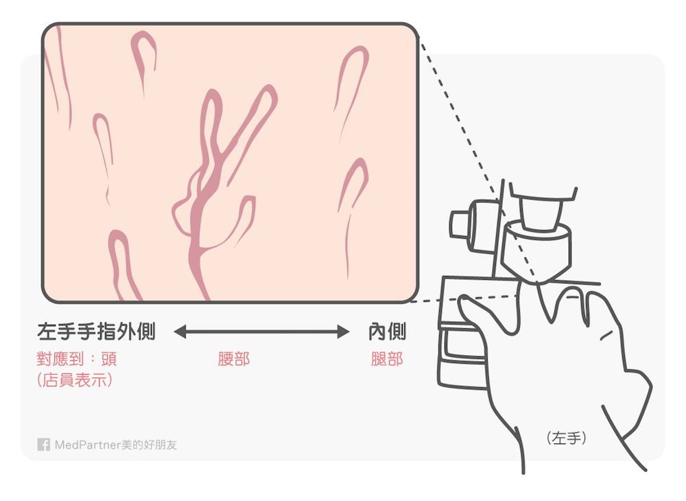 手指微血管