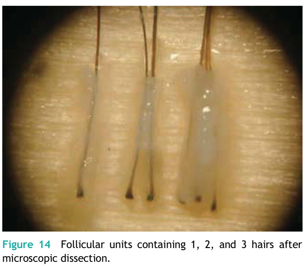 每株毛囊單位不一定只含一根頭髮，有時會有2-3根