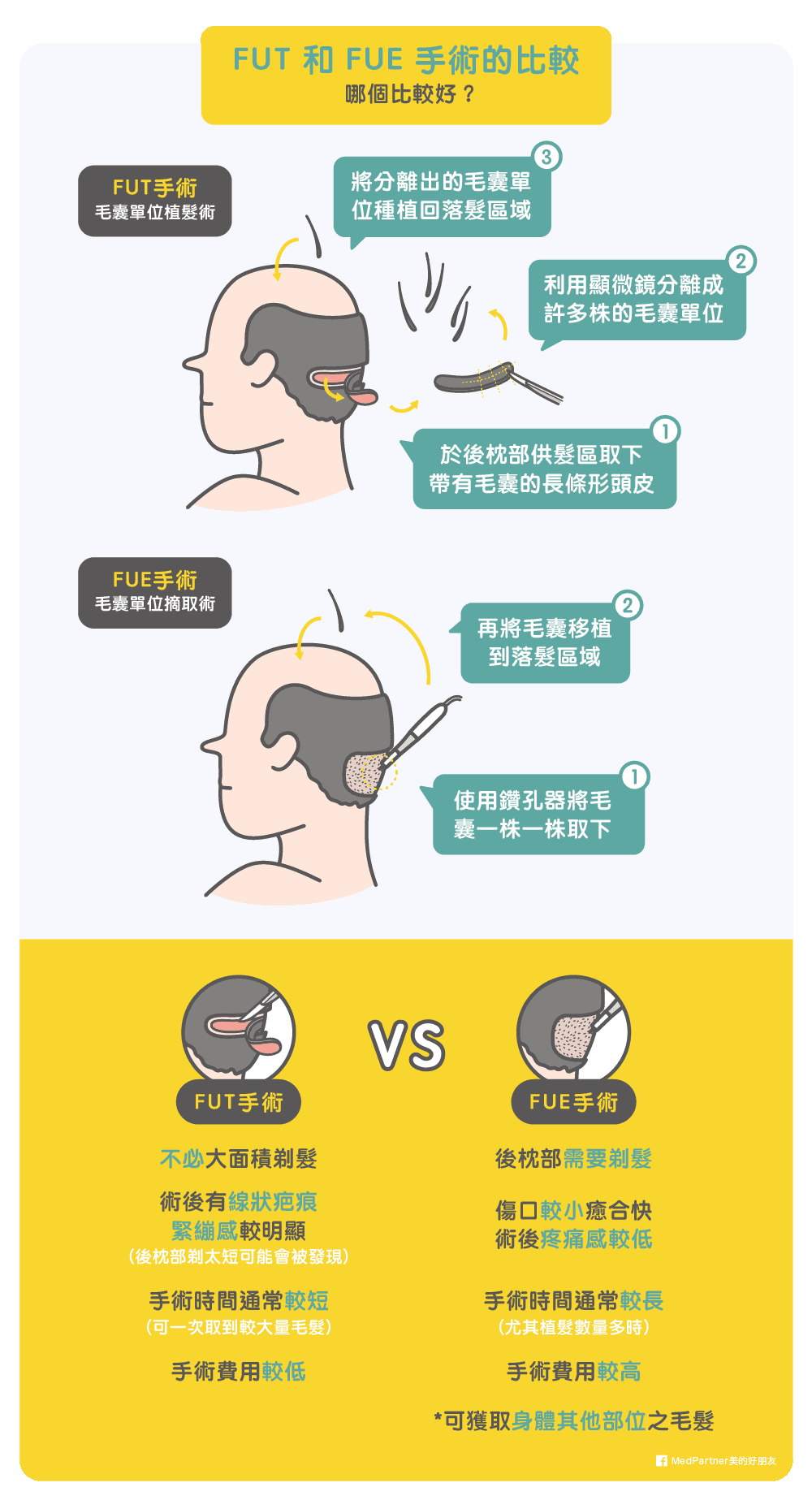 FUT 與 FUE 手術的比較