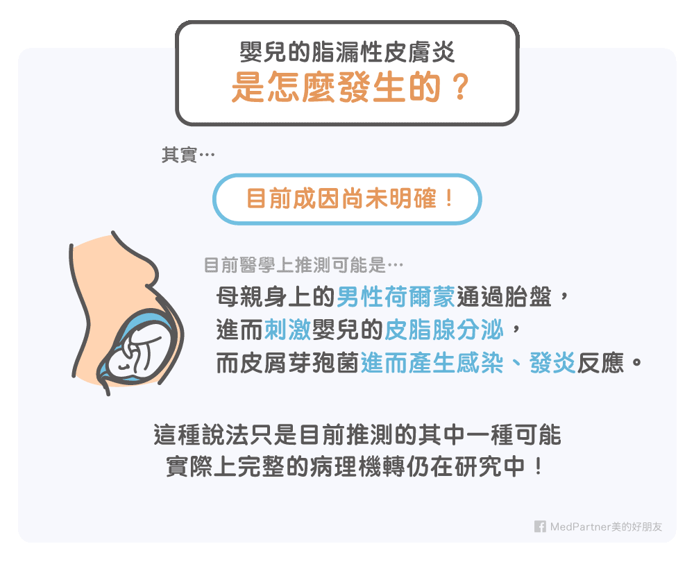 嬰兒脂漏性皮膚炎可能成因