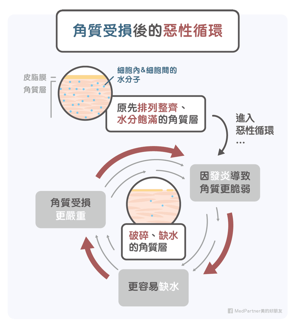 角質受損惡性循環