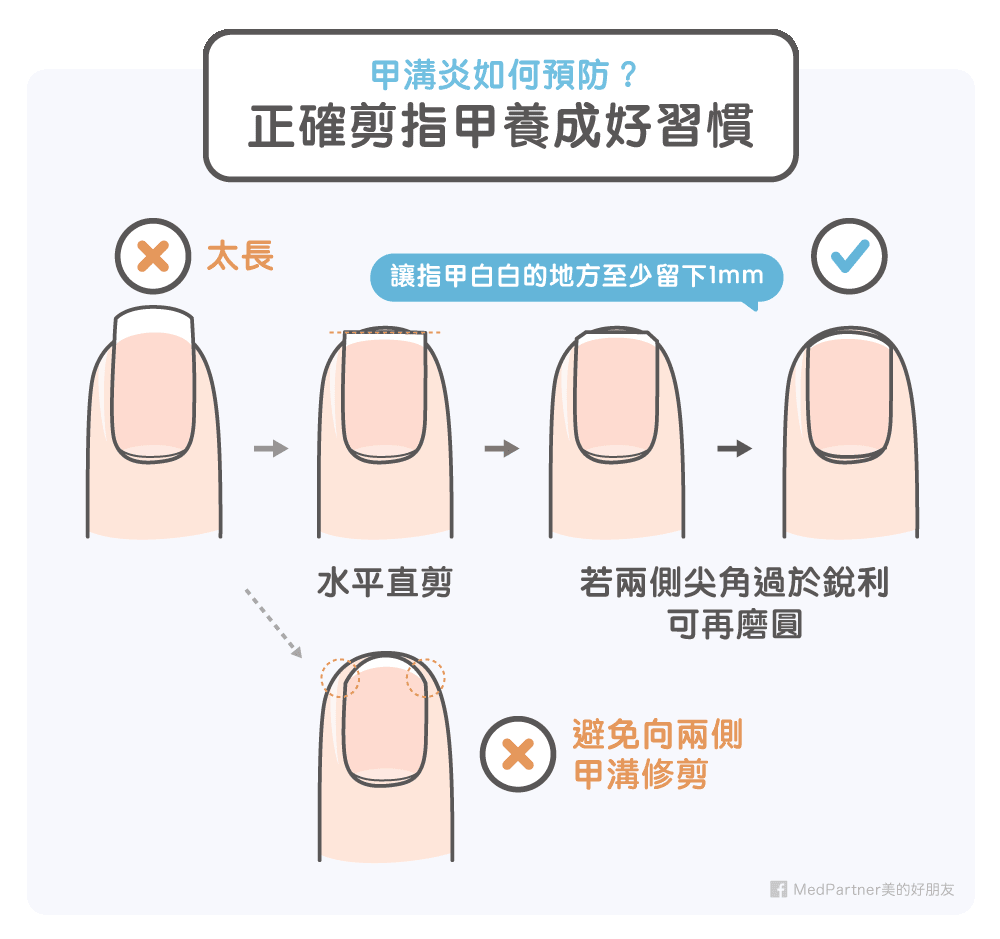 正確剪指甲的習慣