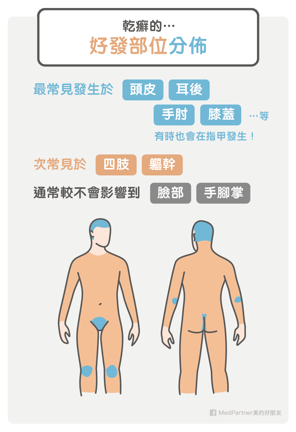 乾癬的好發部位