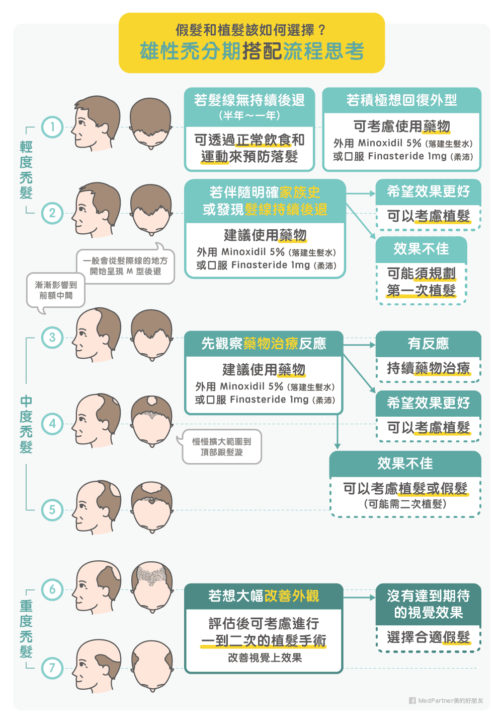 雄性禿分期搭配流程思考