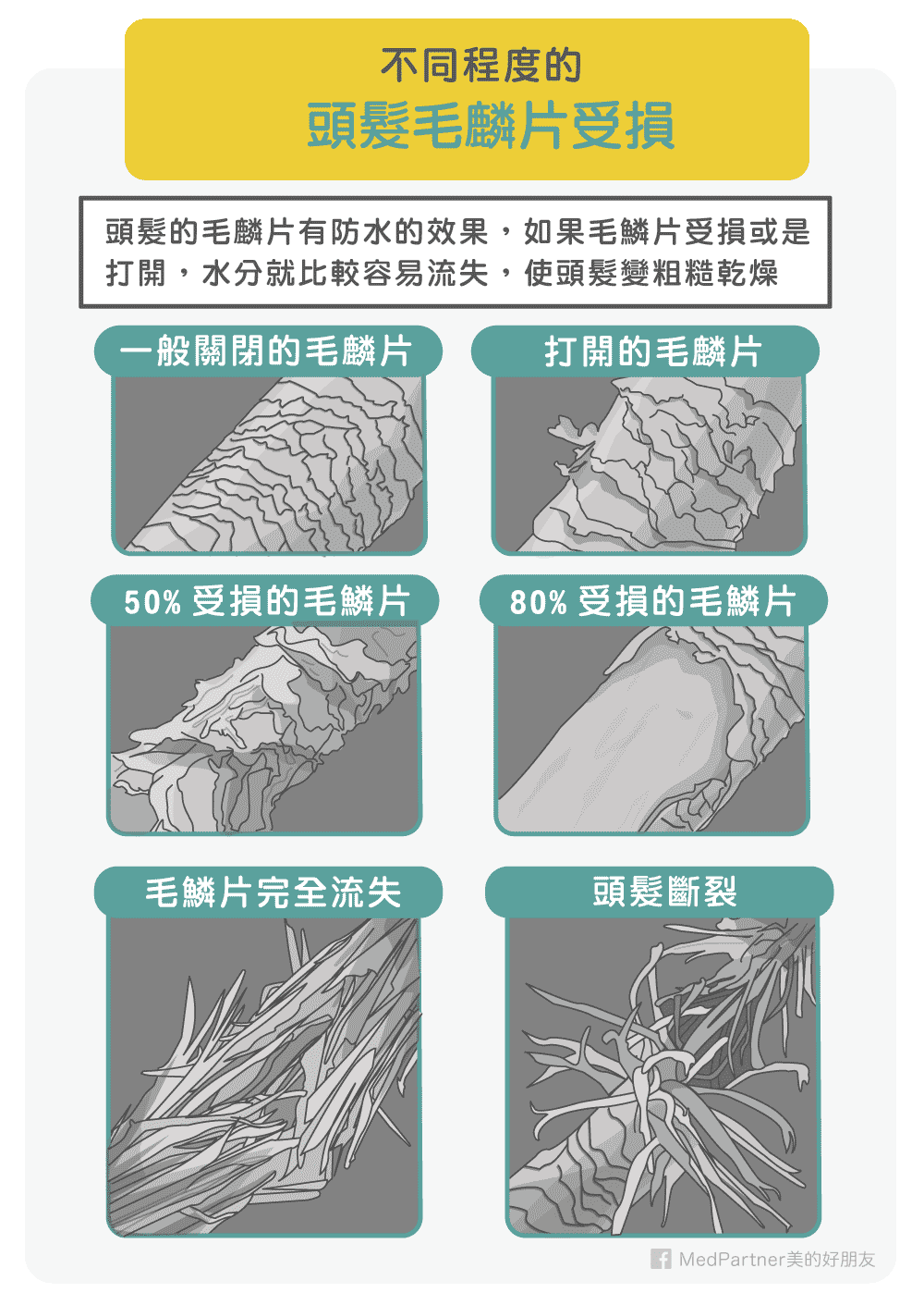 不同頭髮毛鱗片受損程度