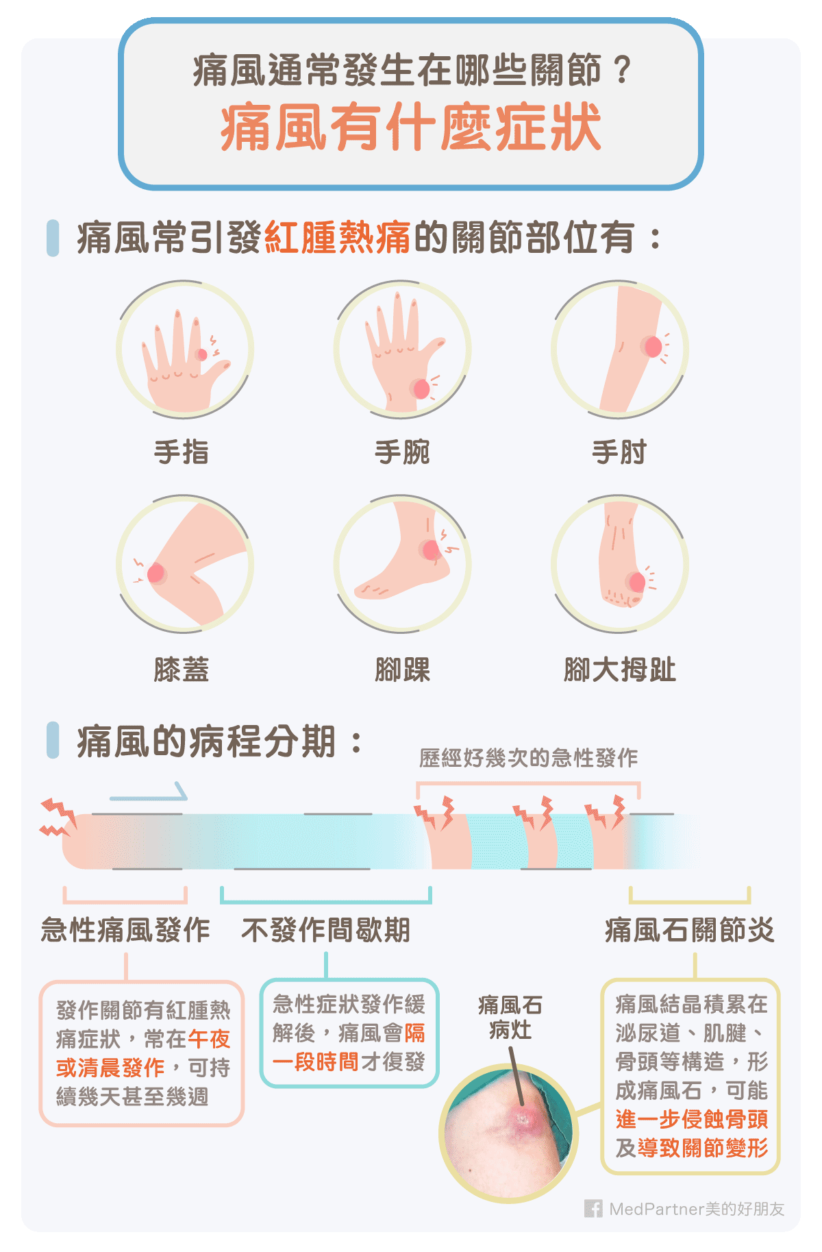 痛風 原因