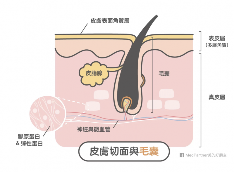 粉刺迷思＿皮膚切面