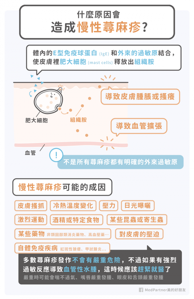 慢性蕁麻疹的成因