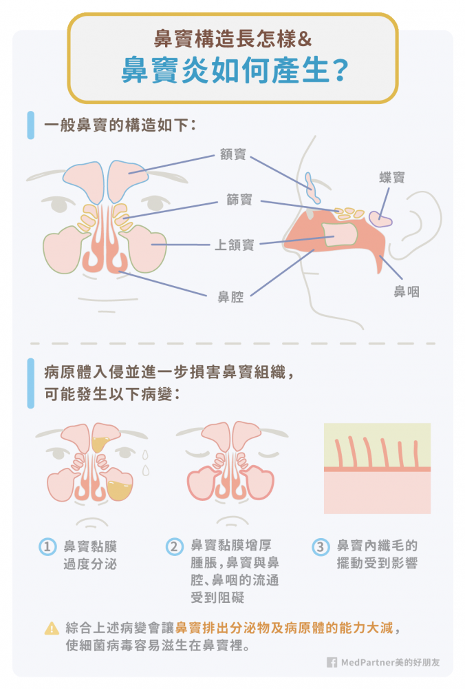 鼻竇炎症狀有哪些 如何治療與預防 醫師完整說明 美的好朋友