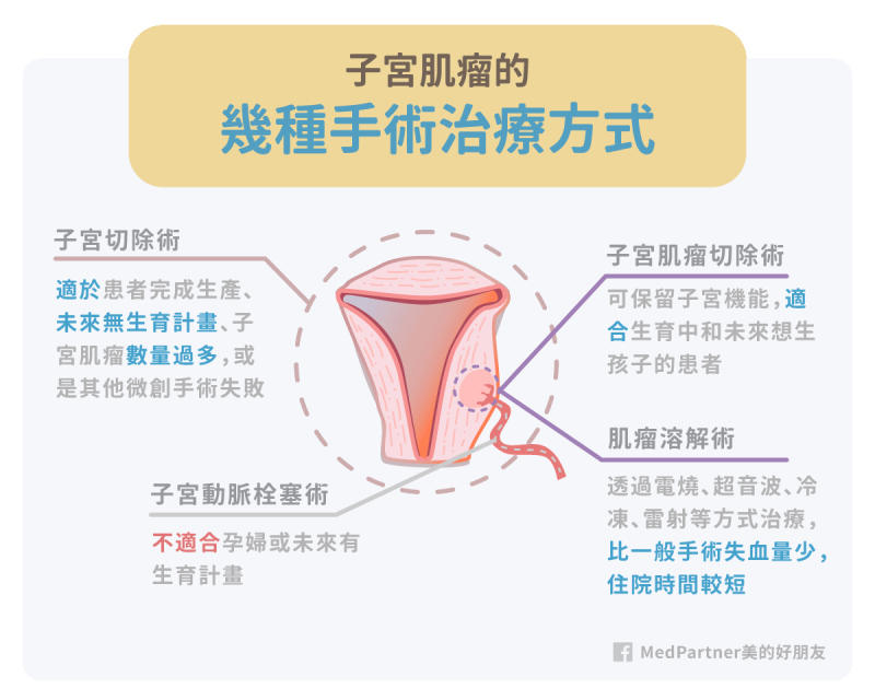 常見子宮肌瘤手術治療方式