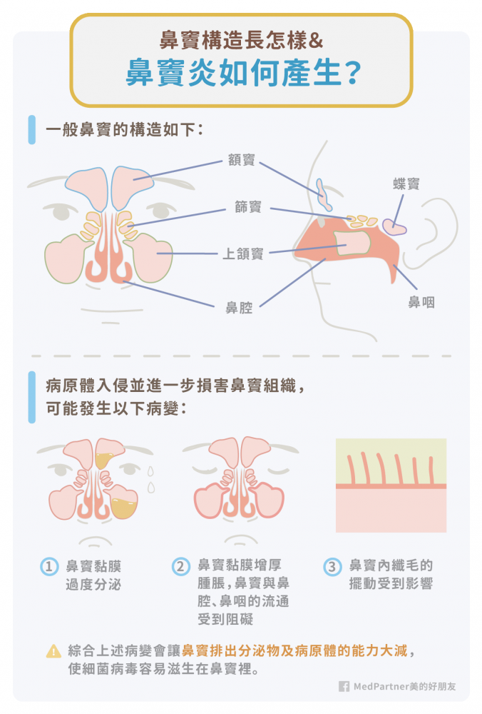 鼻竇的構造與鼻竇炎成因