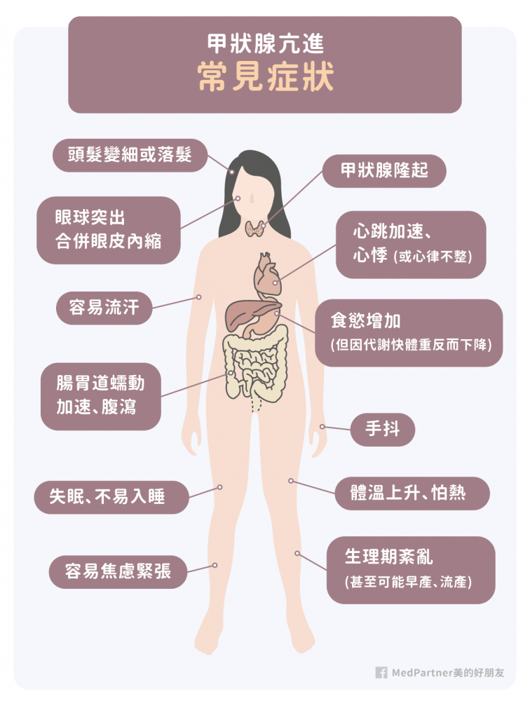 甲狀腺亢進的常見症狀