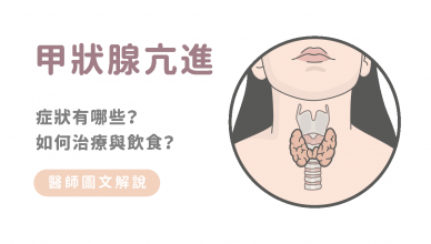 甲狀腺亢進的症狀與治療