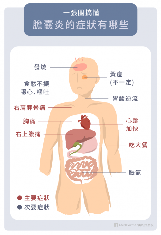 膽囊炎的常見症狀