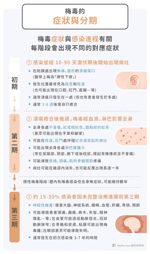 梅毒的症狀與分期