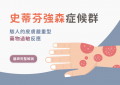 史帝芬強森症候群